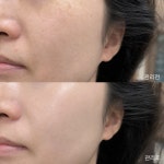 뷰에라 스킨앤스칼프
