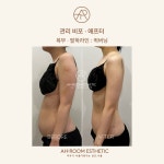 이룸디자인스킨왕십리역사점 | 아룸에스테틱 왕십리센트라스점