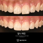 서울더자연치과의원