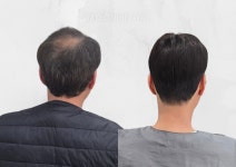 케이위그스투디오가발토탈뷰티샵 | 명인 맞춤가발WIG