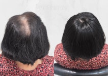 케이위그스투디오가발토탈뷰티샵 | 명인 맞춤가발WIG