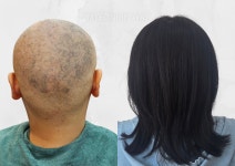 케이위그스투디오가발토탈뷰티샵 | 명인 맞춤가발WIG