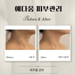 예다움 피부관리