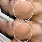 뷔에고에스테틱 김포점