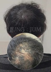 부산두피케어G&B아카데미 | 정점 두피&탈모관리 부산본점