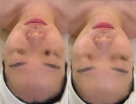 뷔에고에스테틱 김포점