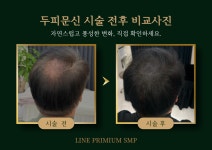 라인