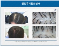 웰킨두피탈모센터 부천점