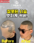 창원두피 디블랙