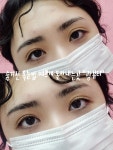 광(光)블리인셀덤 | 광뷰티