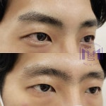 메디미스토리