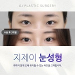 지제이성형외과의원