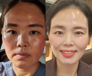 인셀덤 샤이닝 드림 | 인셀덤드림빛나다