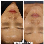 라인메이드스킨케어