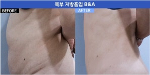더멘토성형외과의원