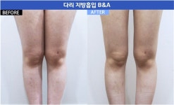 더멘토성형외과의원