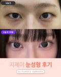 지제이성형외과의원