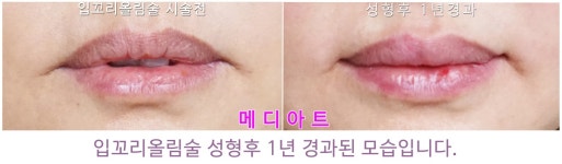 메디아트의원