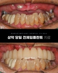 하루임플치과의원