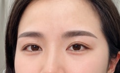 아이두