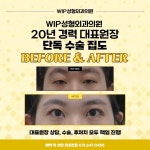 WIP성형외과의원