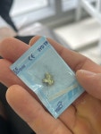 정덴탈 금니거래소