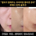 루메디