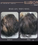 일루젼스칼프 안양