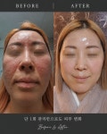 로덱스&리버스화장품수원.광교
