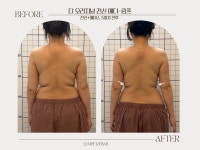 림프리햅에스테틱