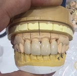 오늘하자치과기공소