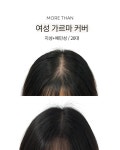대구두피문신 모어댄smp