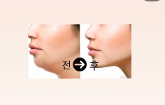 담에스테틱 광양점