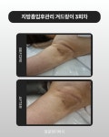 얼굴핏더바디