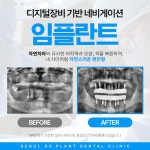 서울DS플란트치과의원