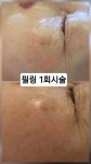 민스킨케어