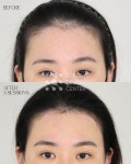 스칼프디자인센터
