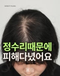 스칼프디자인센터