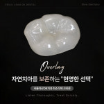서울아산OK치과의원