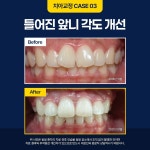 이편한세상치과의원 강서점