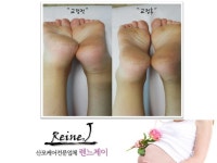 전후사진-렌느제이안양·군포·의왕지점