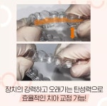 진료과목-보스톤클래식치과