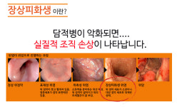 장상피화생 클리닉-위장치료청혈해독 위존한의원