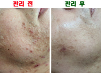 장기동피부관리후기-김포피부관리 김민희스파유르