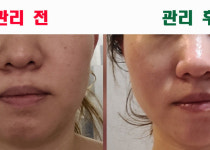 장기동피부관리후기-김포피부관리 김민희스파유르