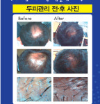 두피케어-옻안타는천연염색 퇴계원점