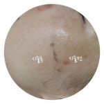 갤러리-창원 피부빛나다
