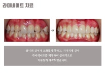 원데이클리닉-내이처럼치과병원