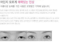 이런눈 저런성형-노원역 노원연세성형외과의원
