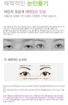 연세챠밍쌍꺼풀-노원역 노원연세성형외과의원